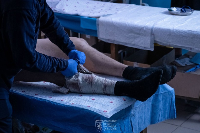 Перев'язка пораненої ноги. Медик обережно знімає просочені кров'ю та забруднені бинти, щоб оглянути рану й накласти нову стерильну пов'язку.